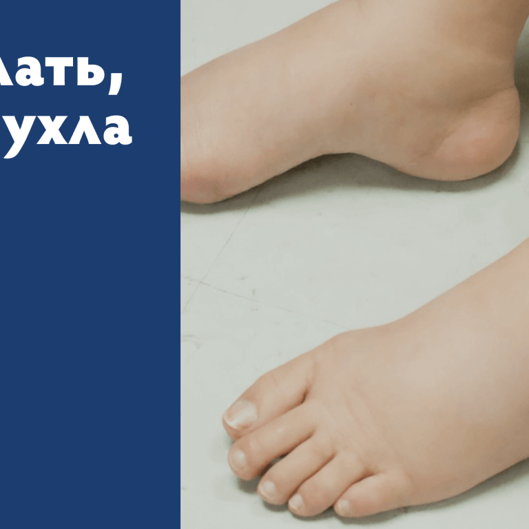 Приметы: почему горят ступни ног и что они означают