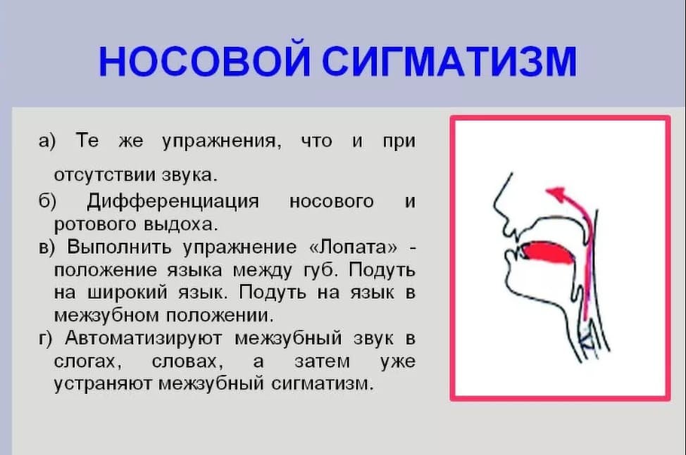 Речевые нарушения у детей: причины и методы профилактики