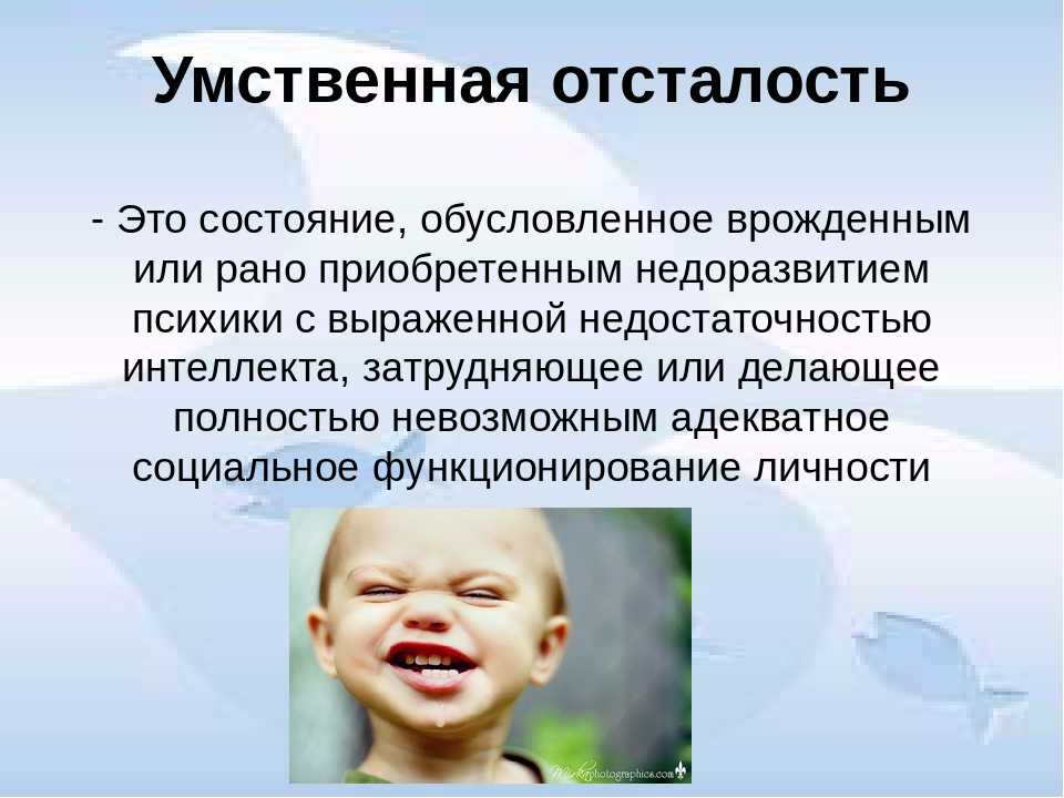Объясняем смысл термина "баранья тупость"