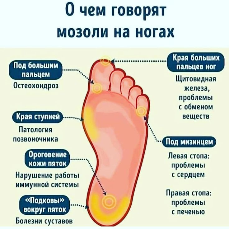 С левой ноги встал нехорош сон привиделся... - смысл пословицы, значение, толкование