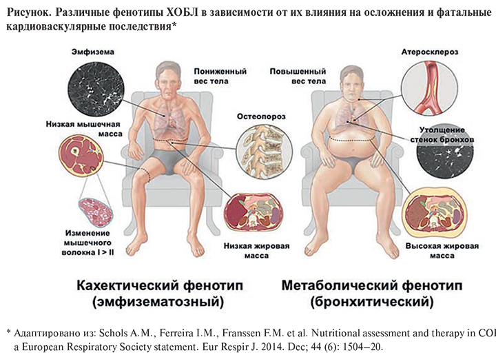 Буриданов осел, или почему с выбором лучше не затягивать | блог 4brain