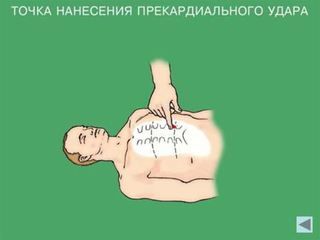 Как сделать удушающий прием - виды удушающих приемов в борьбе