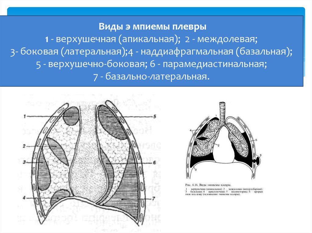 Индетерминантные и детерминантные сорта томатов: что это такое и как их выращивать?
